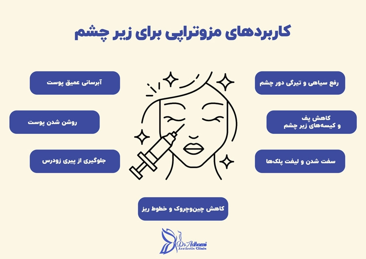 کاربردهای مزوتراپی زیر چشم